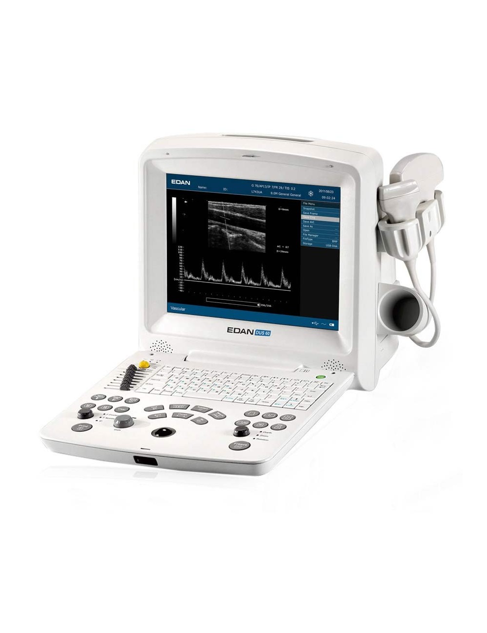 ECHOGRAPHE PORTABLE DOPPLER DUS 60 # + 1 SONDE CONVEXE ET BATTERIE