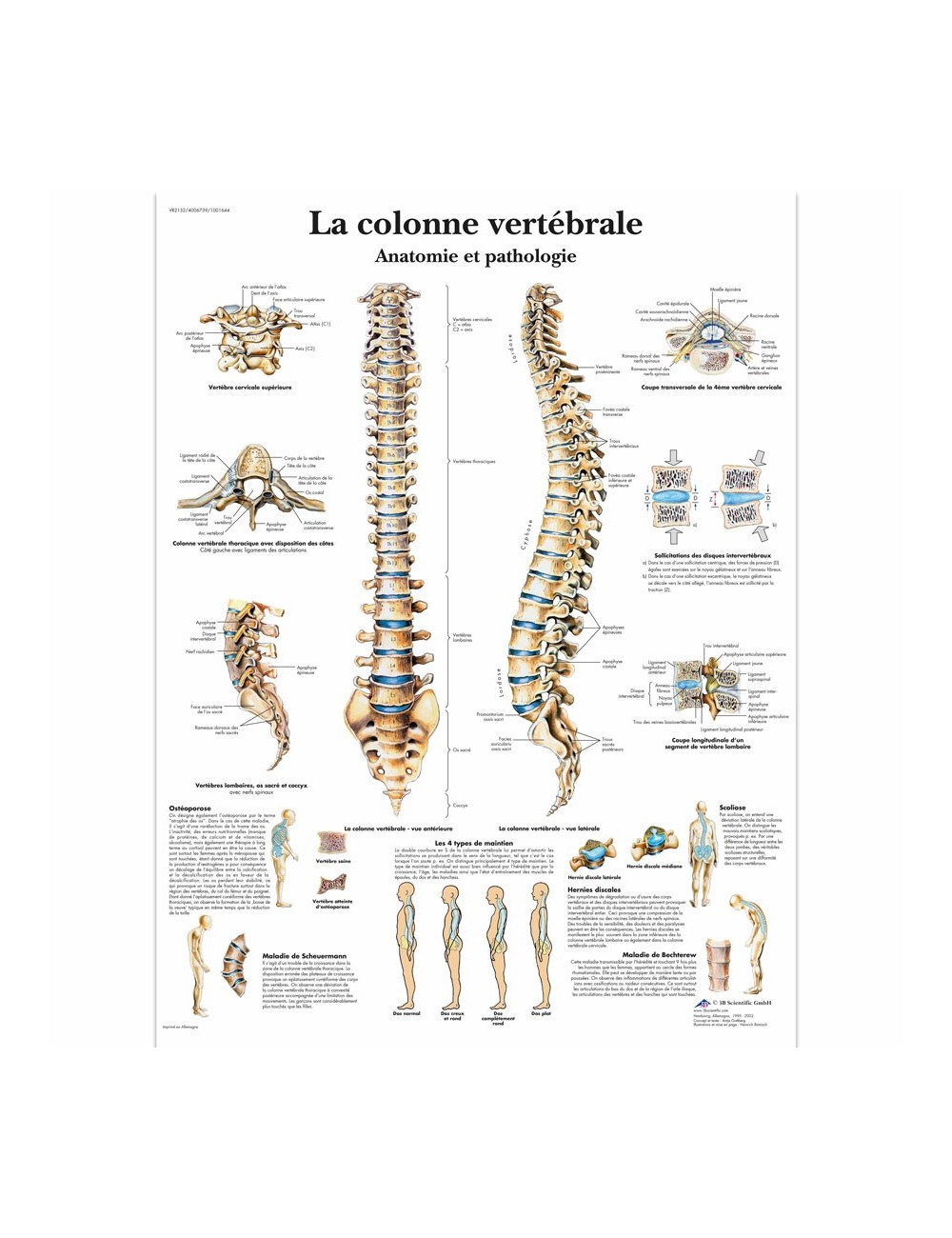 POSTER COLONNE VERTEBRALE ANATOMIE ET PATHOLOGIE