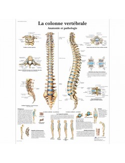 POSTER COLONNE VERTEBRALE ANATOMIE ET PATHOLOGIE