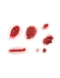 ASSORTIMENT BLESSURES