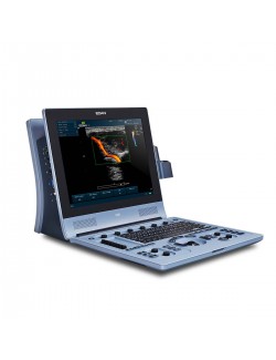 ECHOGRAPHE PORTABLE COULEUR DOPPLER U60 EDAN + 1 SONDE#