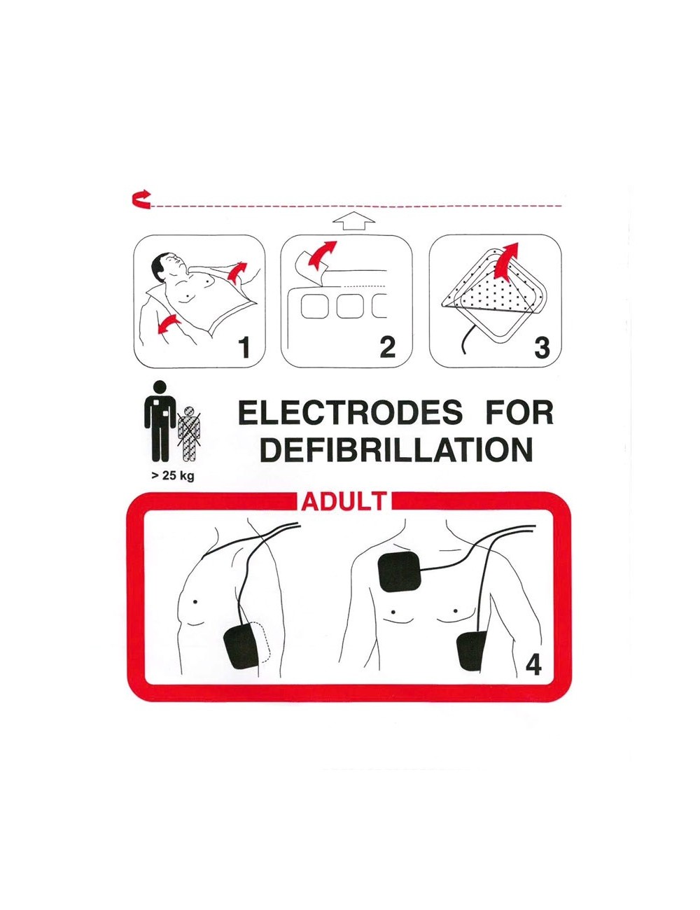 PAIRE D'ELECTRODES ADULTE PRE-CONNECTEE FRE EASY SCHILLER