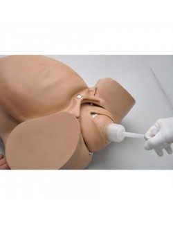 FŒTUS POUR DÉGAGEMENT AVEC VENTOUSE OBSTÉTRICALE