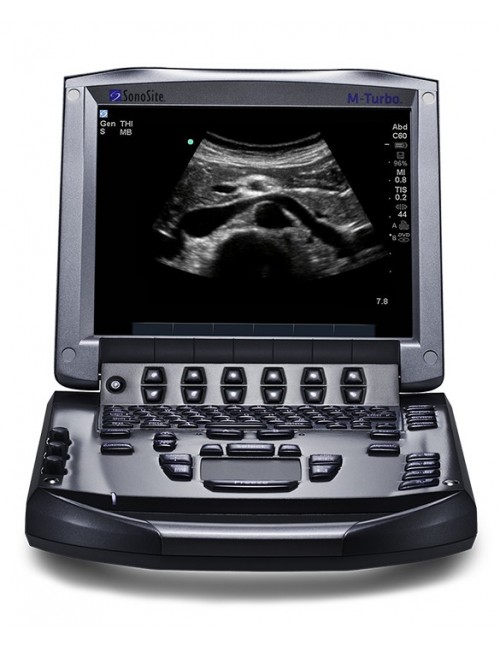 ECHOGRAPHE SONOSITE M-TURBO + SONDE C60XI/5-2MHZ#