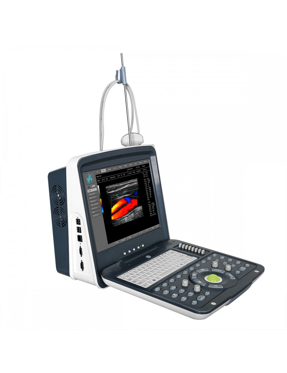 ECHOGRAPHE F61 PORTABLE COULEUR AVEC BATTERIE ET 1 SONDE