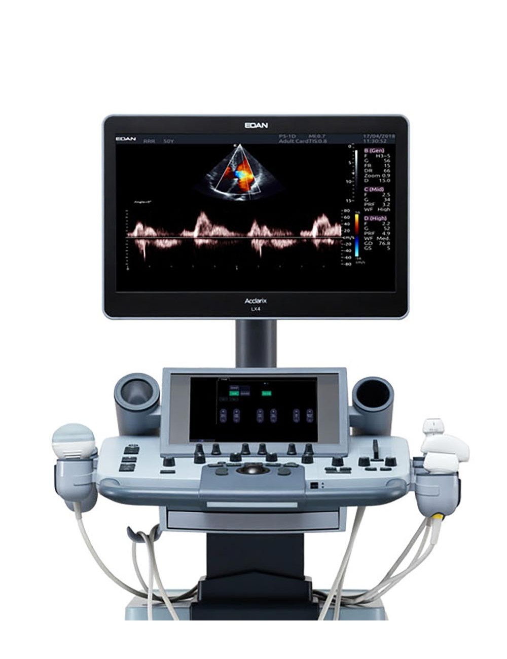 ECHOGRAPHE ACCLARIX LX4 AVEC SONDE CONVEXE ET SONDE LINEAIRE