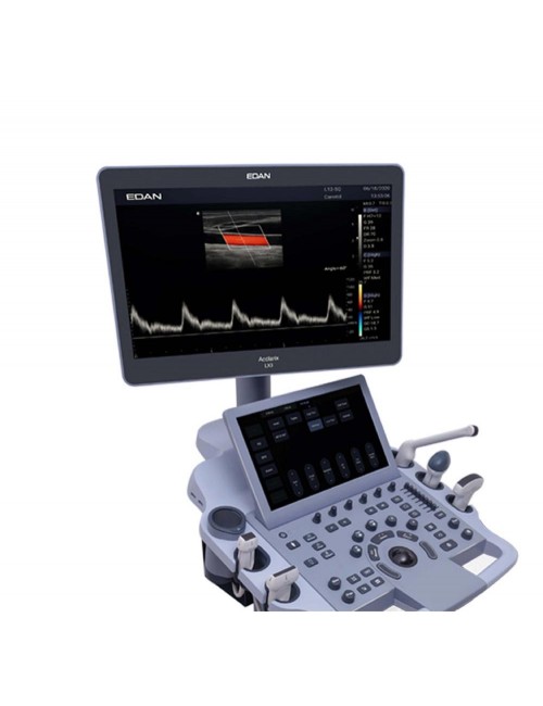 ECHOGRAPHE ACCLARIX LX3 AVEC 4 SONDES ET IMPRIMANTE