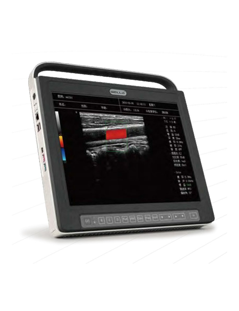 ECHOGRAPHE TABLETTE COULEUR PORTABLE AVEC 1 SONDE W6