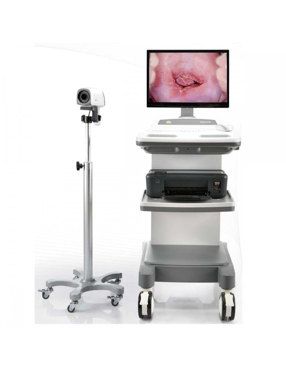 COLPOSCOPE NUMERIQUE